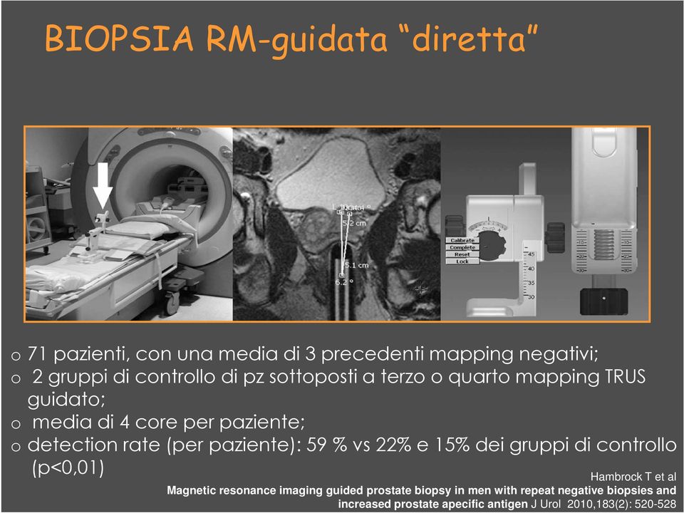 paziente): 59 % vs 22% e 15% dei gruppi di controllo (p<0,01) Hambrock T et al Magnetic resonance imaging guided