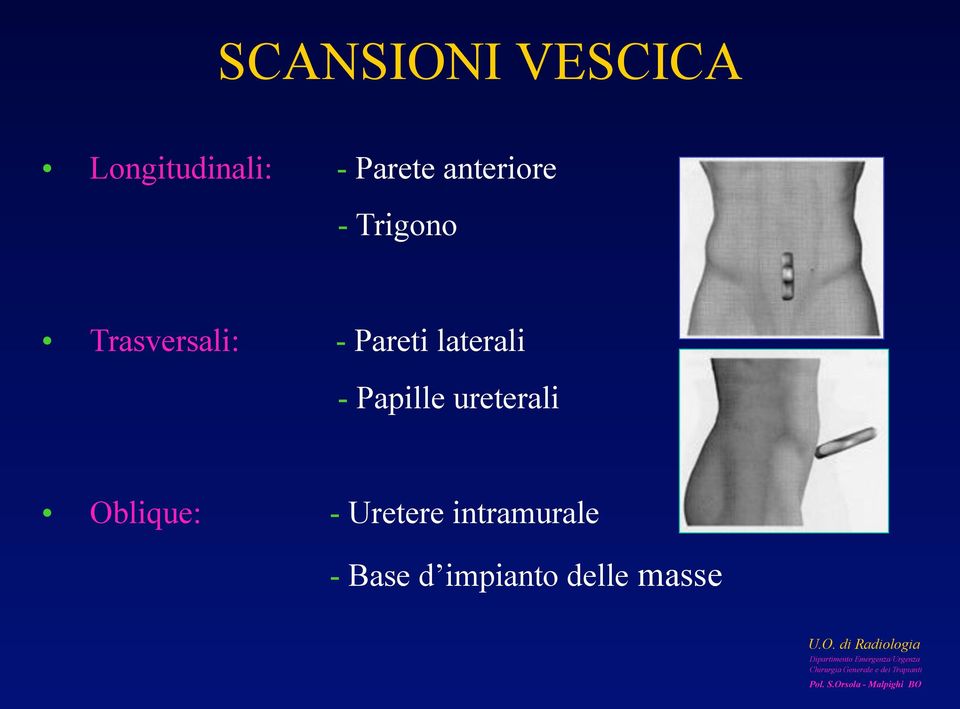 laterali - Papille ureterali Oblique: -