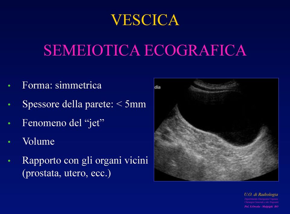 5mm Fenomeno del jet Volume Rapporto