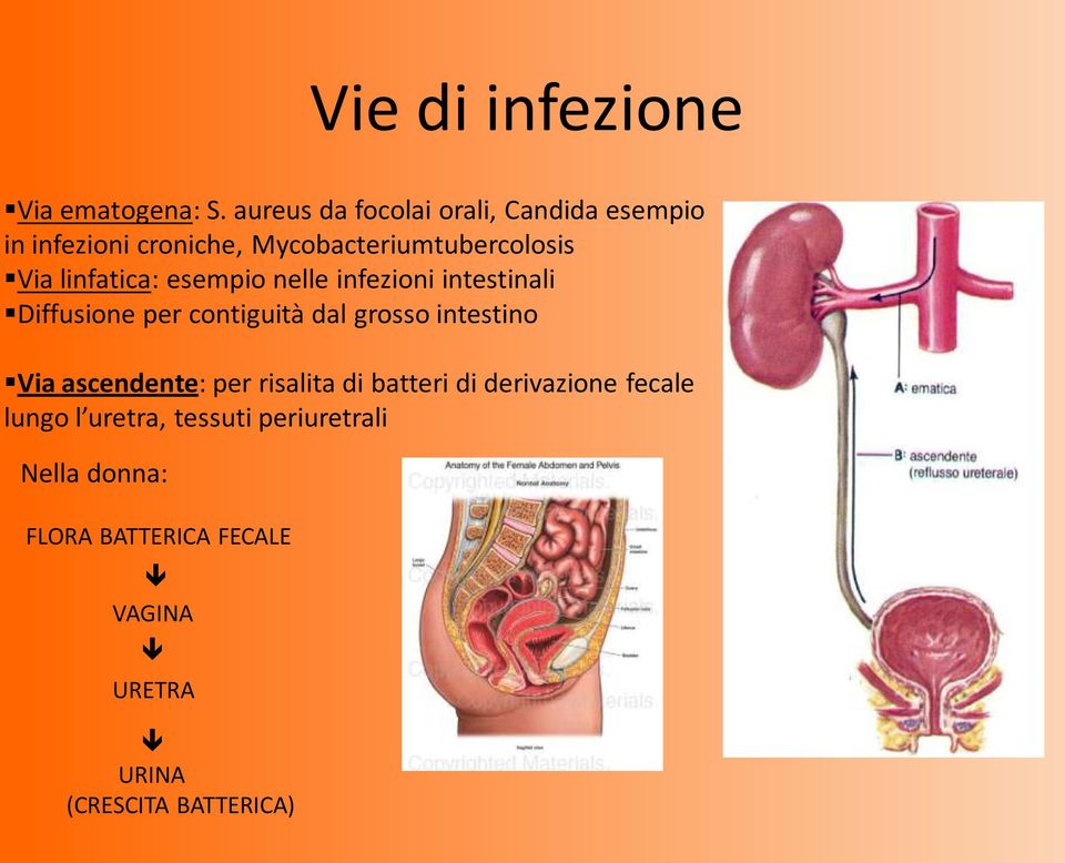linfatica: esempio nelle infezioni intestinali Diffusione per contiguità dal grosso intestino Via