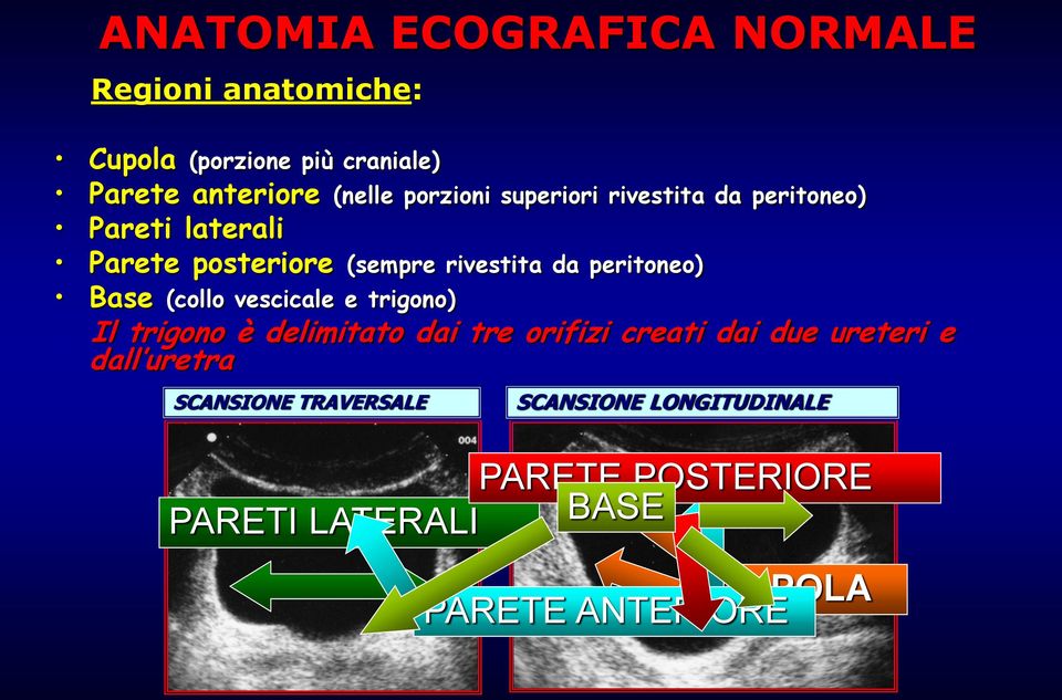 peritoneo) Base (collo vescicale e trigono) Il trigono è delimitato dai tre orifizi creati dai due ureteri