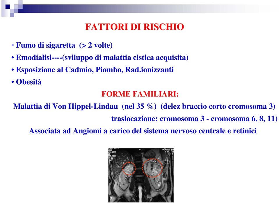 ionizzanti Obesità FORME FAMILIARI: Malattia di Von Hippel-Lindau (nel 35 %) (delez braccio