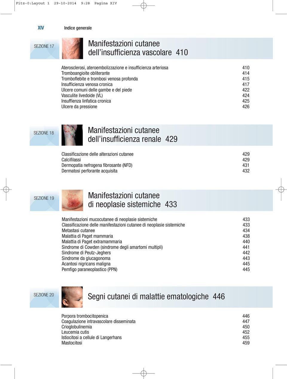 linfatica cronica 425 Ulcere da pressione 426 SEZIONE 18 Manifestazioni cutanee dell insufficienza renale 429 Classificazione delle alterazioni cutanee 429 Calcifilassi 429 Dermopatia nefrogena