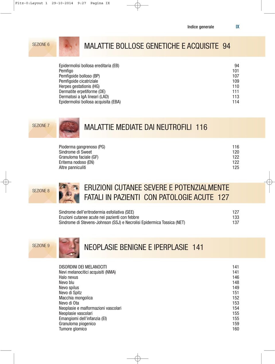 NEUTROFILI 116 Pioderma gangrenoso (PG) 116 Sindrome di Sweet 120 Granuloma faciale (GF) 122 Eritema nodoso (EN) 122 Altre panniculiti 125 SEZIONE 8 ERUZIONI CUTANEE SEVERE E POTENZIALMENTE FATALI IN