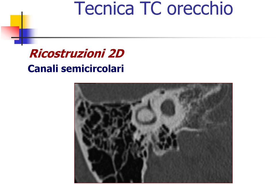 Ricostruzioni