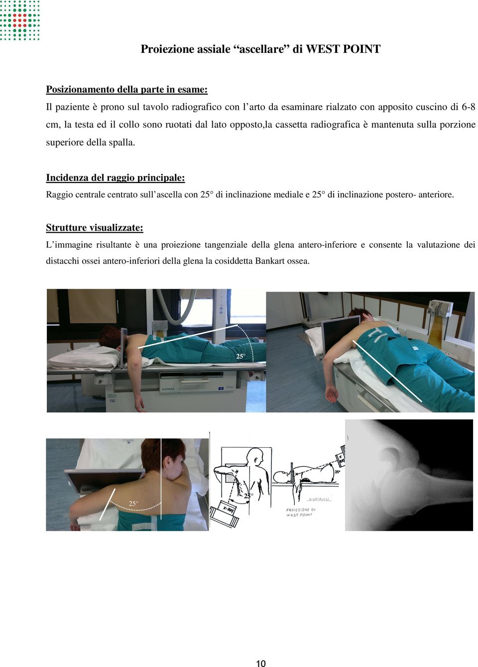 Incidenza del raggio principale: Raggio centrale centrato sull ascella con 25 di inclinazione mediale e 25 di inclinazione postero- anteriore.