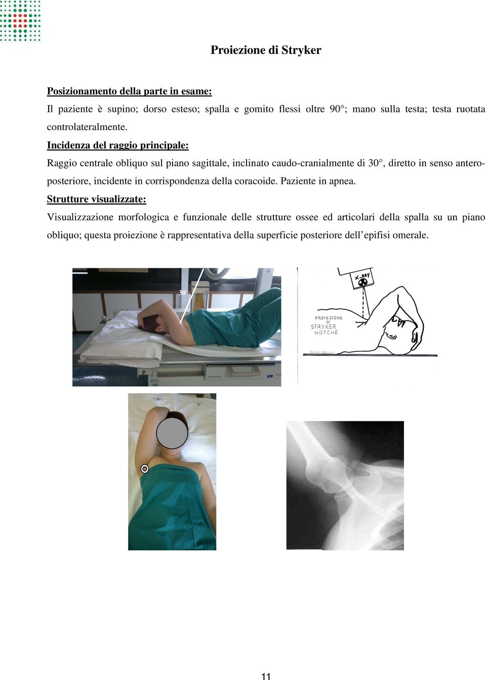 Incidenza del raggio principale: Raggio centrale obliquo sul piano sagittale, inclinato caudo-cranialmente di 30, diretto in senso anteroposteriore,