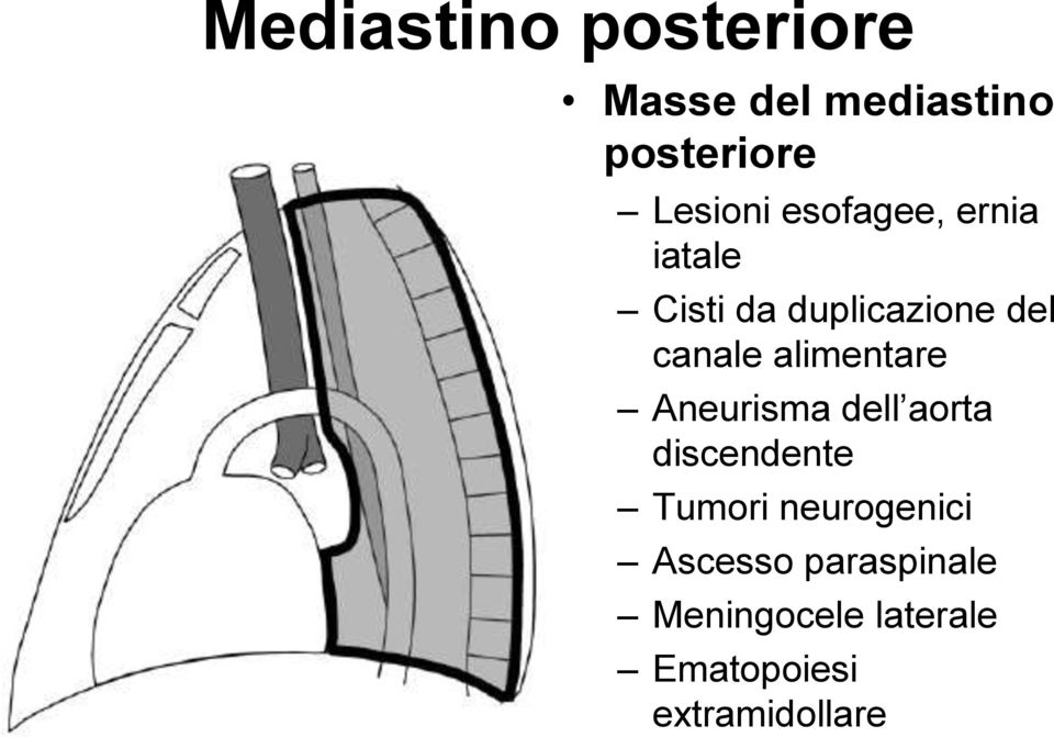 alimentare Aneurisma dell aorta discendente Tumori