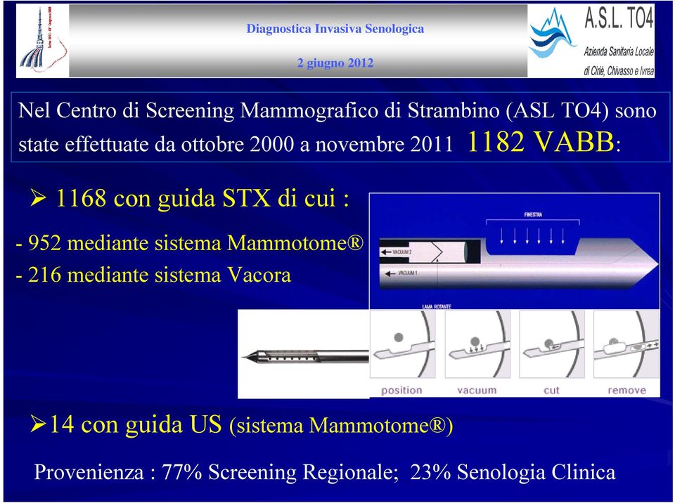 cui : - 952 mediante sistema Mammotome - 216 mediante sistema Vacora 14 con