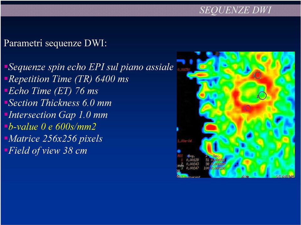 (ET) 76 ms Section Thickness 6.0 mm Intersection Gap 1.