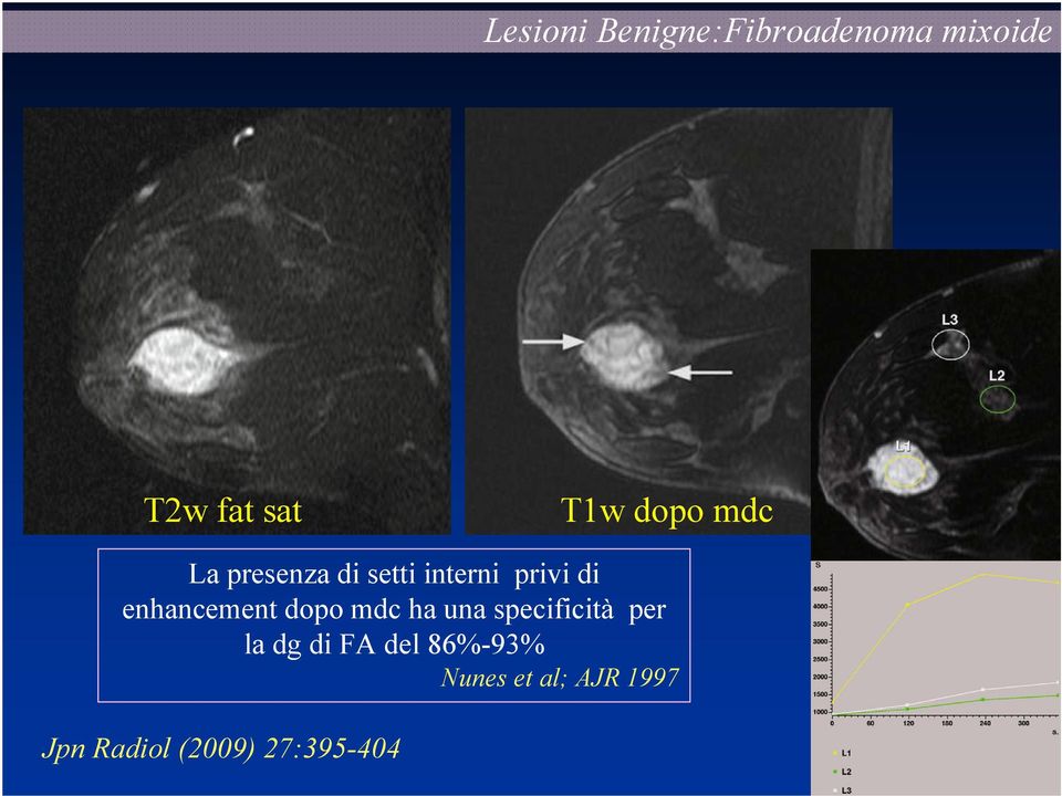 enhancement dopo mdc ha una specificità per la dg di