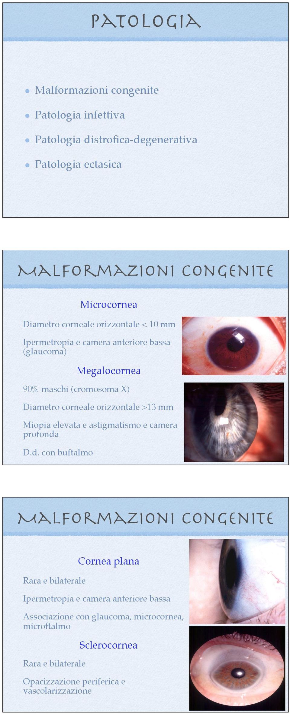 orizzontale >13 mm Miopia elevata e astigmatismo e camera profonda