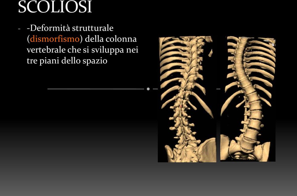 della colonna vertebrale che