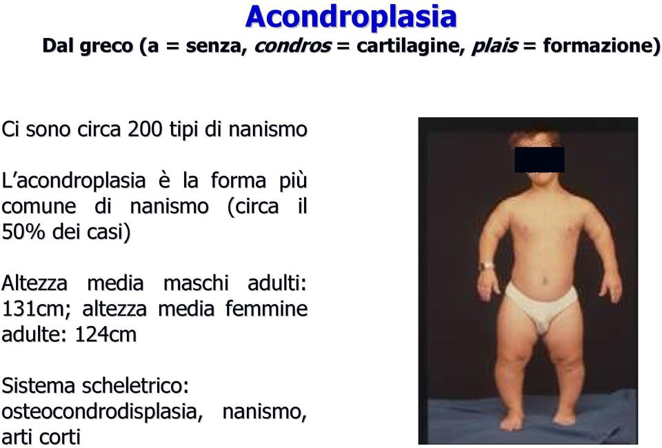 nanismo (circa il 50% dei casi) Altezza media maschi adulti: 131cm; altezza