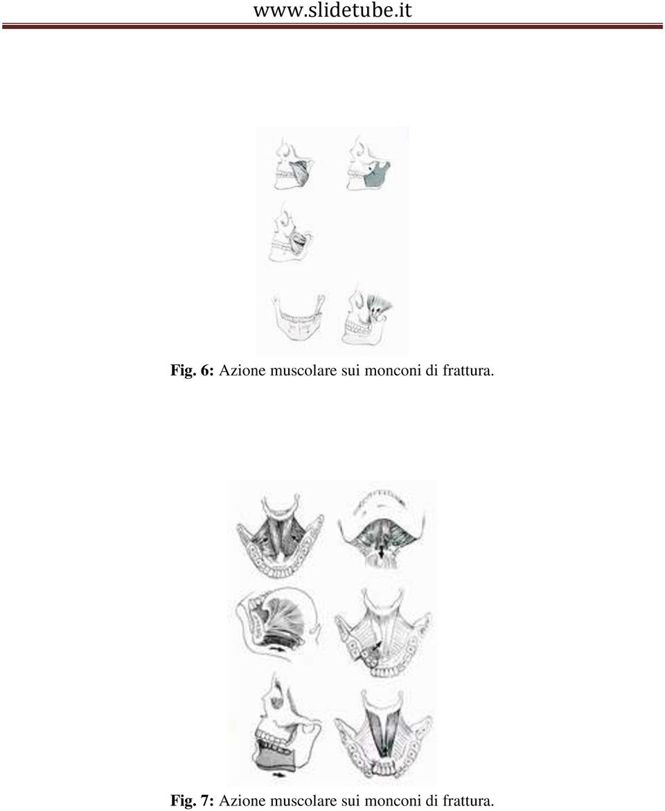 Fig. 7: Azione muscolare