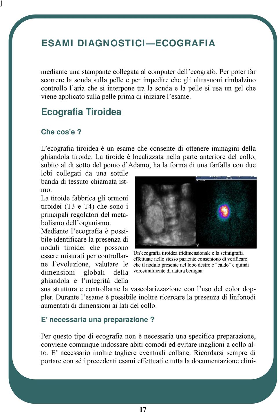 di iniziare l esame. Ecografia Tiroidea Che cos e? L ecografia tiroidea è un esame che consente di ottenere immagini della ghiandola tiroide.