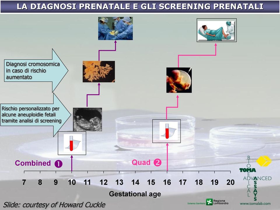 aneuploidie fetali tramite analisi di screening Combined Quad 7 8 9 10