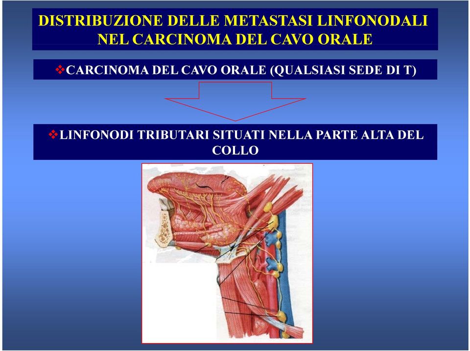 DI T) LINFONODI TRIBUTARI SITUATI NELLA PARTE ALTA DEL