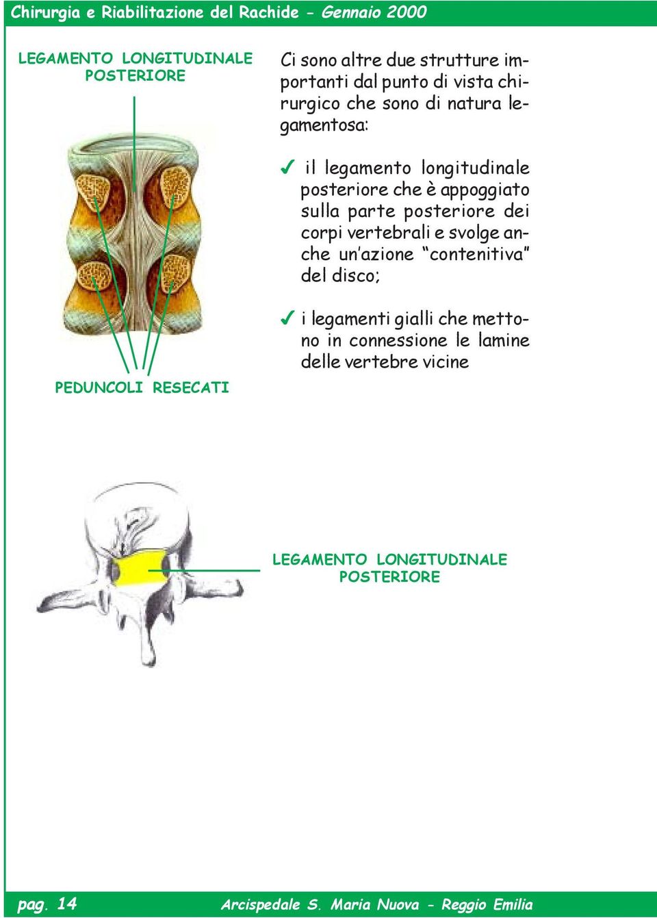 posteriore dei corpi vertebrali e svolge anche un azione contenitiva del disco; PEDUNCOLI RESECATI i legamenti gialli che mettono