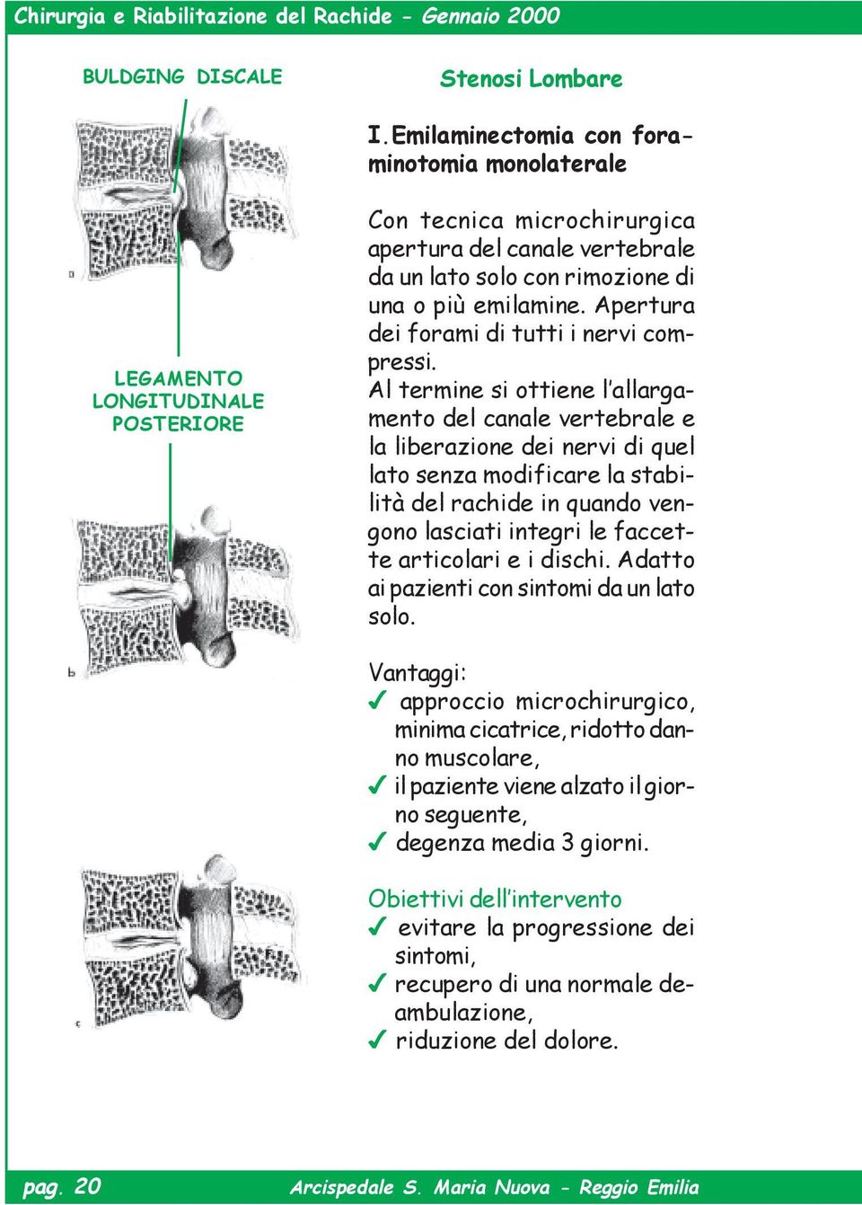 Apertura dei forami di tutti i nervi compressi.