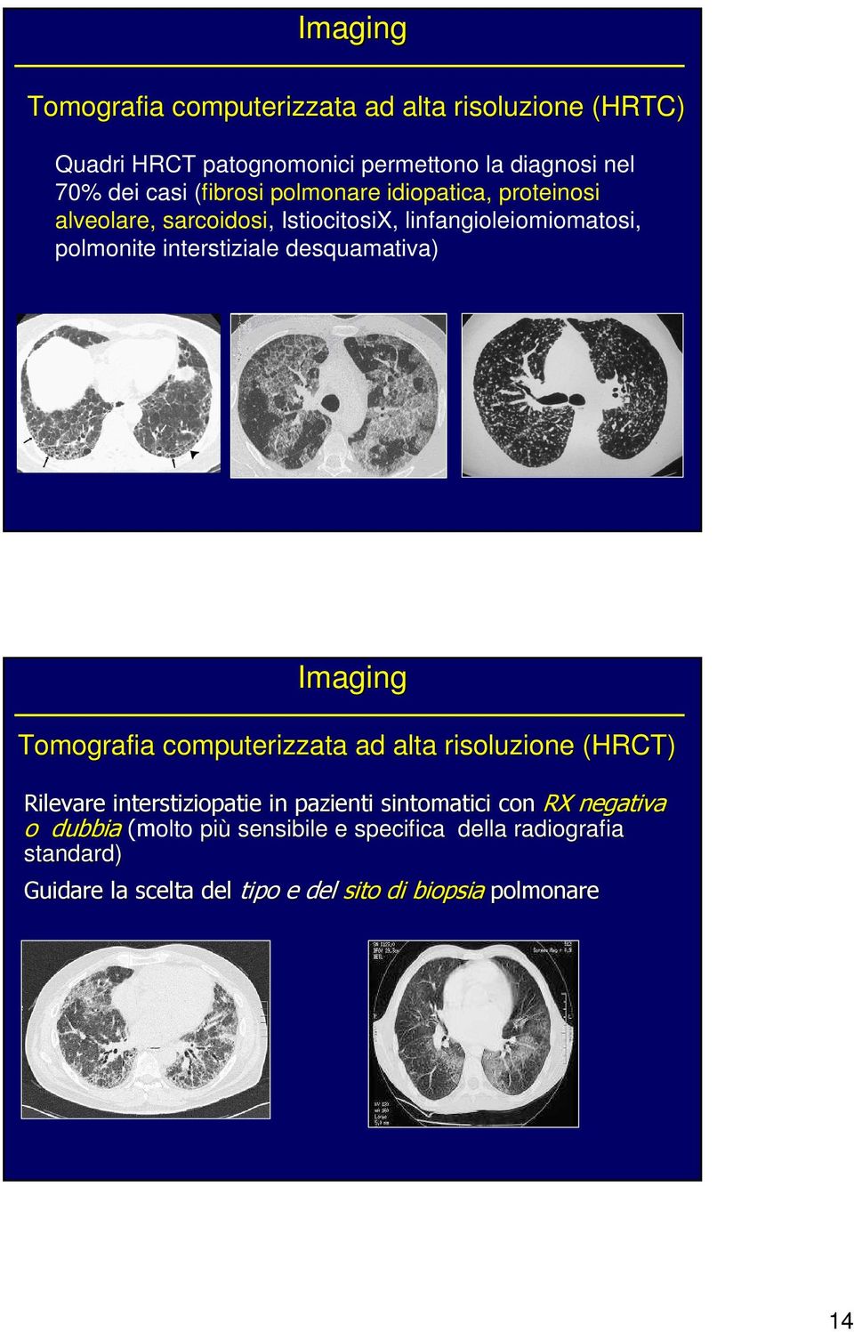 desquamativa) Imaging Tomografia computerizzata ad alta risoluzione (HRCT) Rilevare interstiziopatie in pazienti sintomatici con RX
