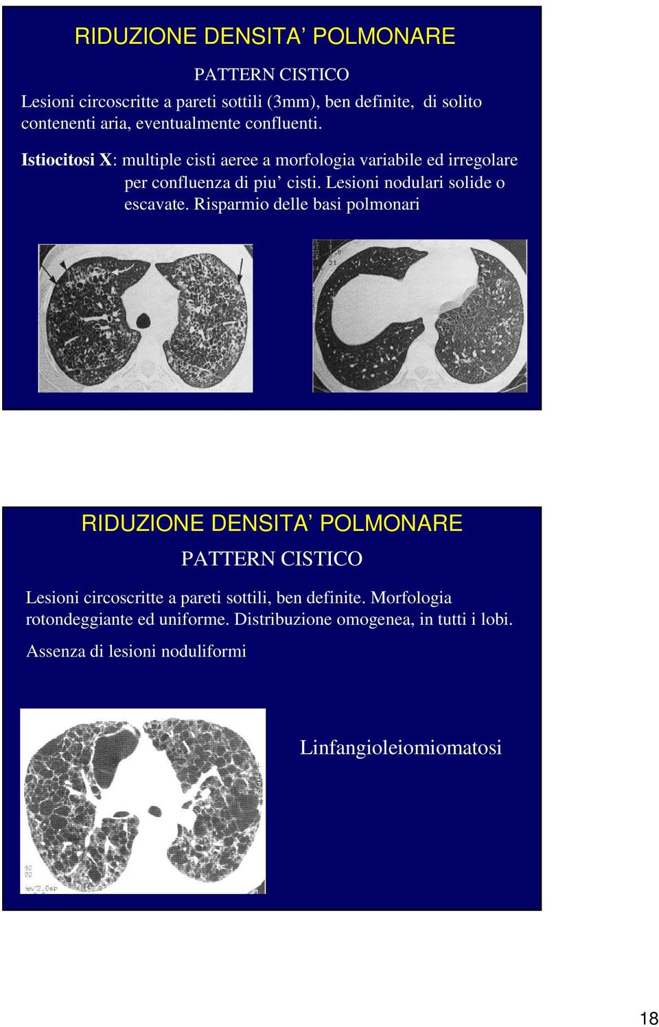 Lesioni nodulari solide o escavate.