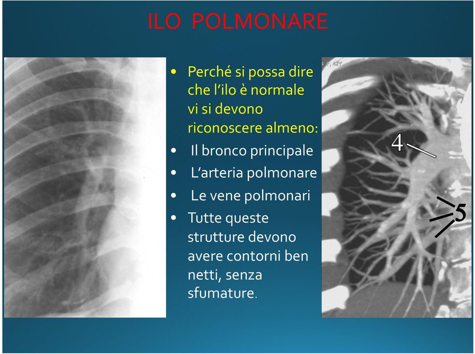 L arteria polmonare Le vene polmonari Tutte queste