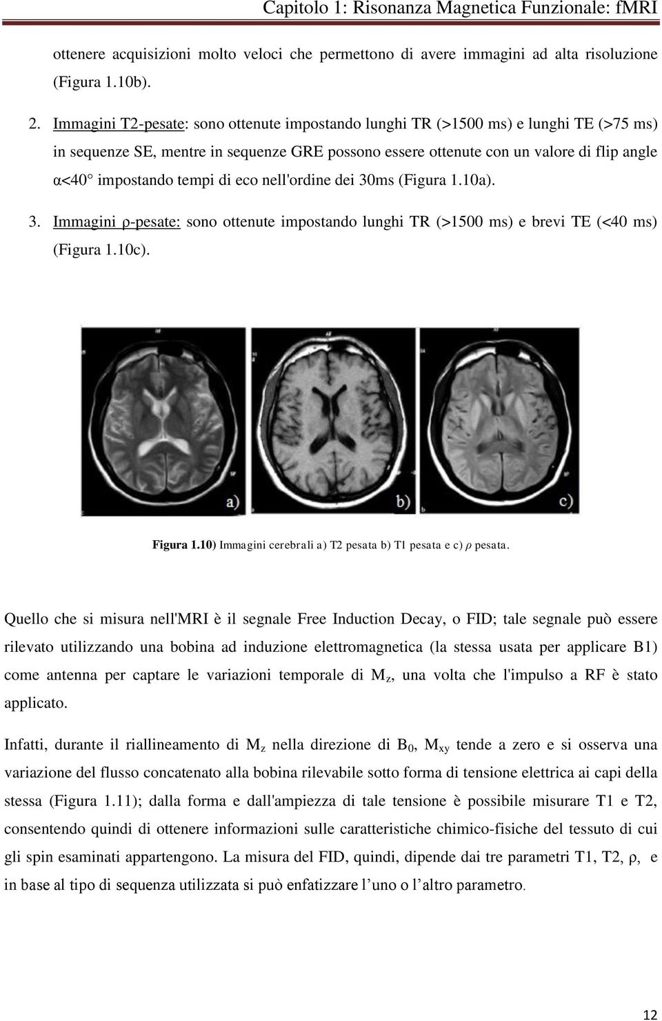 di eco nell'ordine dei 30ms (Figura 1.10a). 3. Immagini ρ-pesate: sono ottenute impostando lunghi TR (>1500 ms) e brevi TE (<40 ms) (Figura 1.10c). Figura 1.