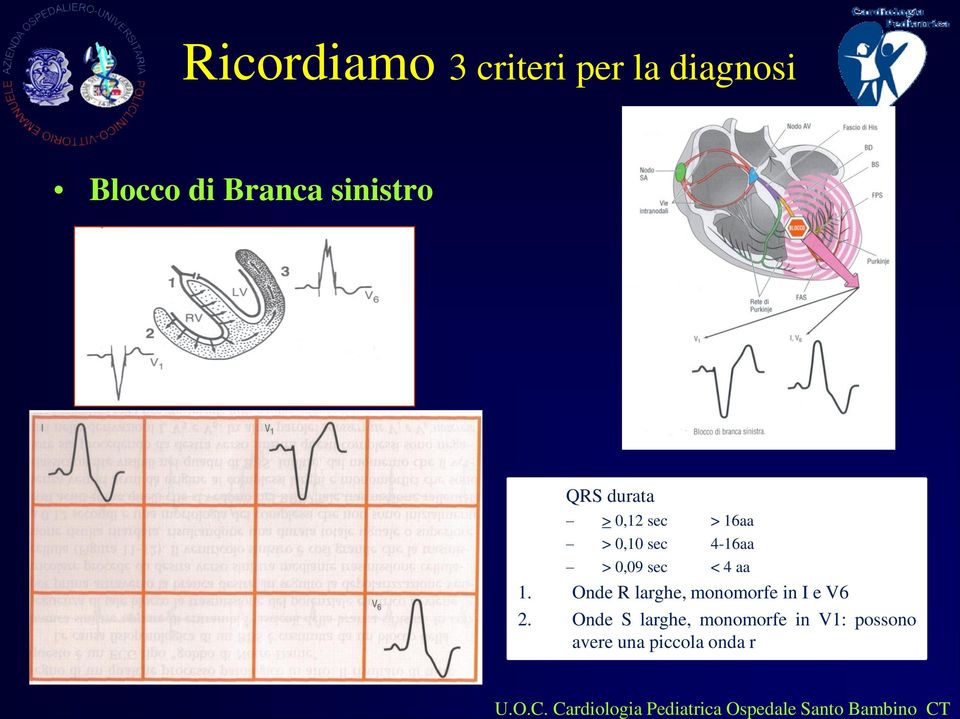 0,09 sec < 4 aa 1. Onde R larghe, monomorfe in I e V6 2.