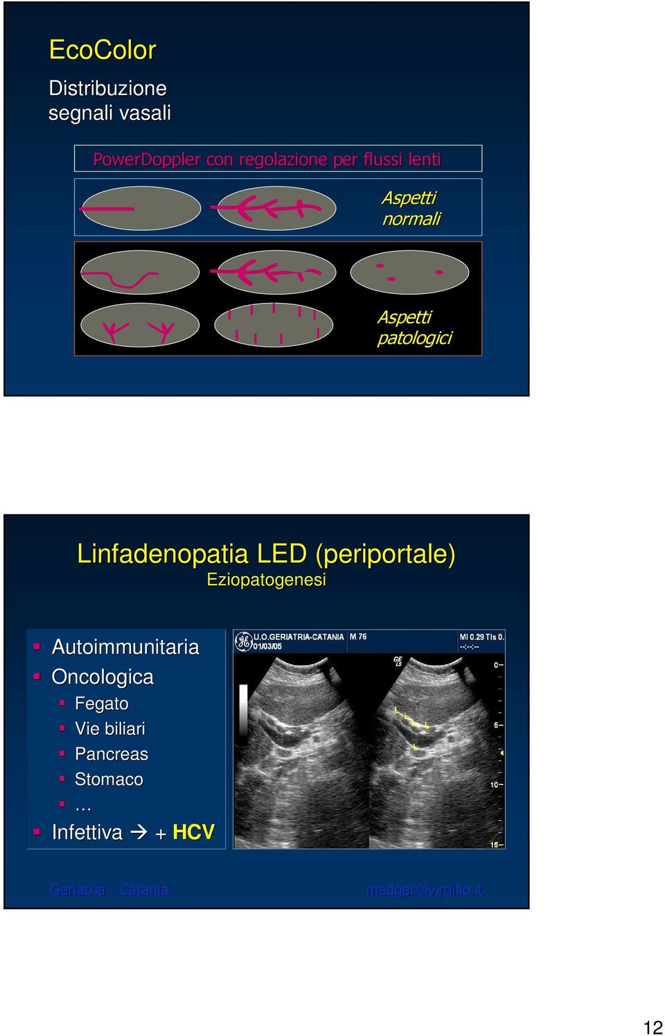 LED (periportale( periportale) Eziopatogenesi Autoimmunitaria