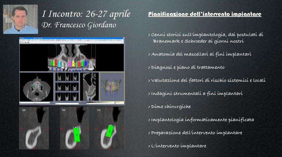 Branemark e Schroeder ai giorni nostri Anatomia dei mascellari ai fini implantari Diagnosi e piano di trattamento