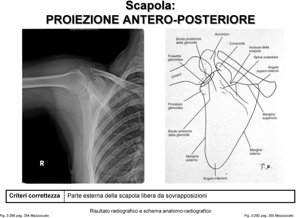 sovrapposizioni Fig. 3-290 pag.