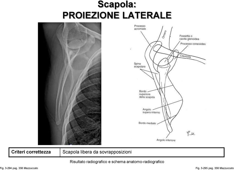 radiografico e schema anatomo-radiografico Fig.