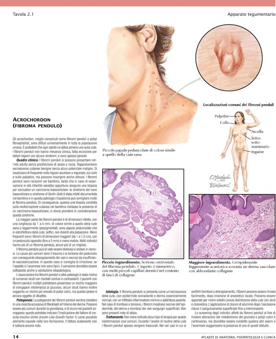 È probabile che ogni adulto ne abbia almeno uno sulla cute. I fibromi penduli non hanno rilevanza clinica, fatta eccezione per deboli legami con alcune sindromi, e sono spesso ignorati.