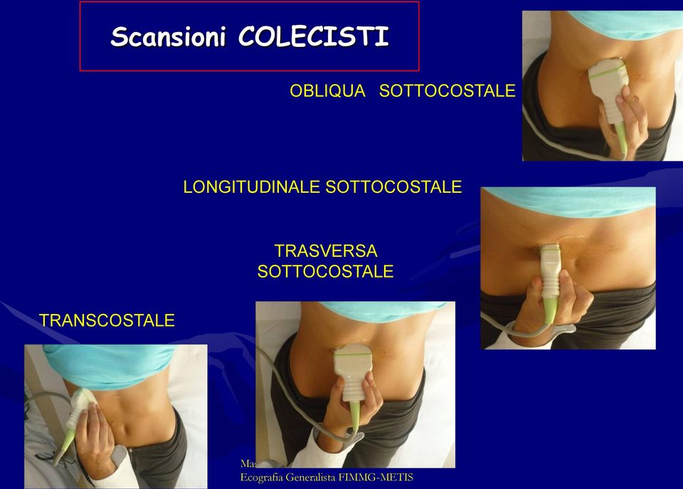 SOTTOCOSTALE TRANSCOSTALE Massimo Covanti -