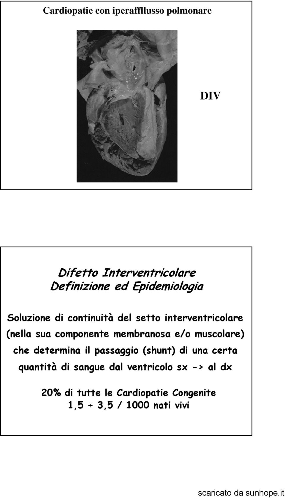 membranosa e/o muscolare) che determina il passaggio (shunt) di una certa quantità di