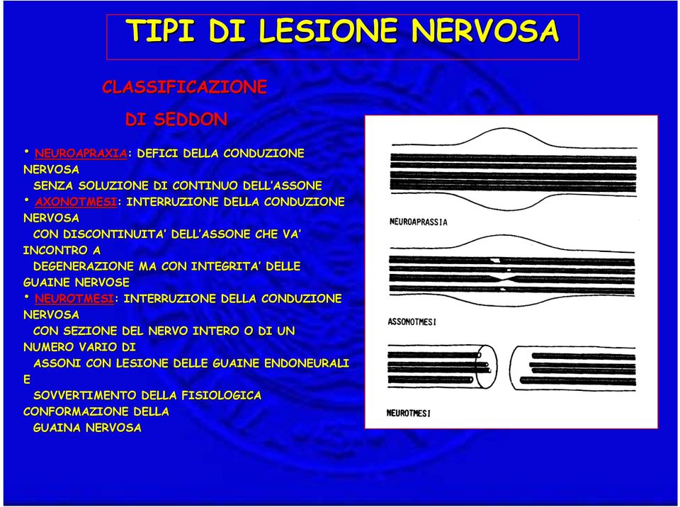 MA CON INTEGRITA DELLE GUAINE NERVOSE NEUROTMESI: : INTERRUZIONE DELLA CONDUZIONE NERVOSA CON SEZIONE DEL NERVO INTERO O DI UN