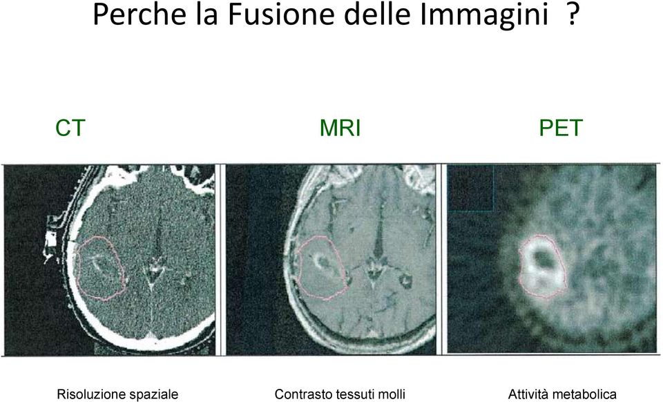 CT MRI PET Risoluzione