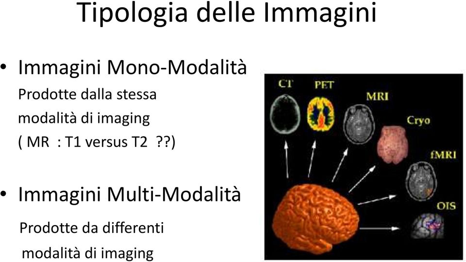 di imaging ( MR : T1 versus T2?