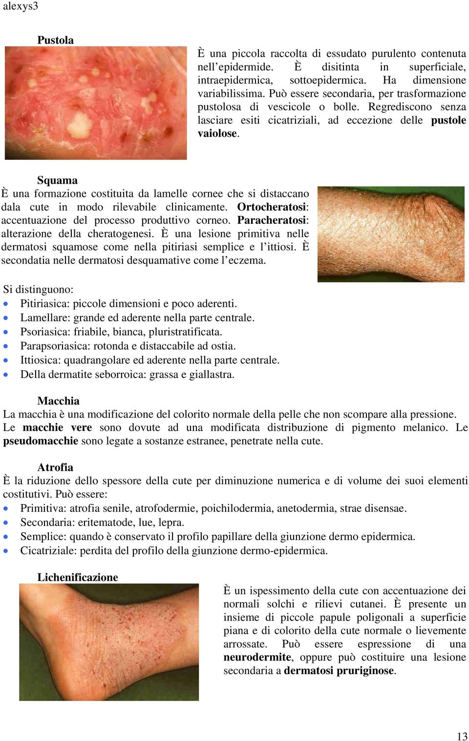 Squama È una formazione costituita da lamelle cornee che si distaccano dala cute in modo rilevabile clinicamente. Ortocheratosi: accentuazione del processo produttivo corneo.