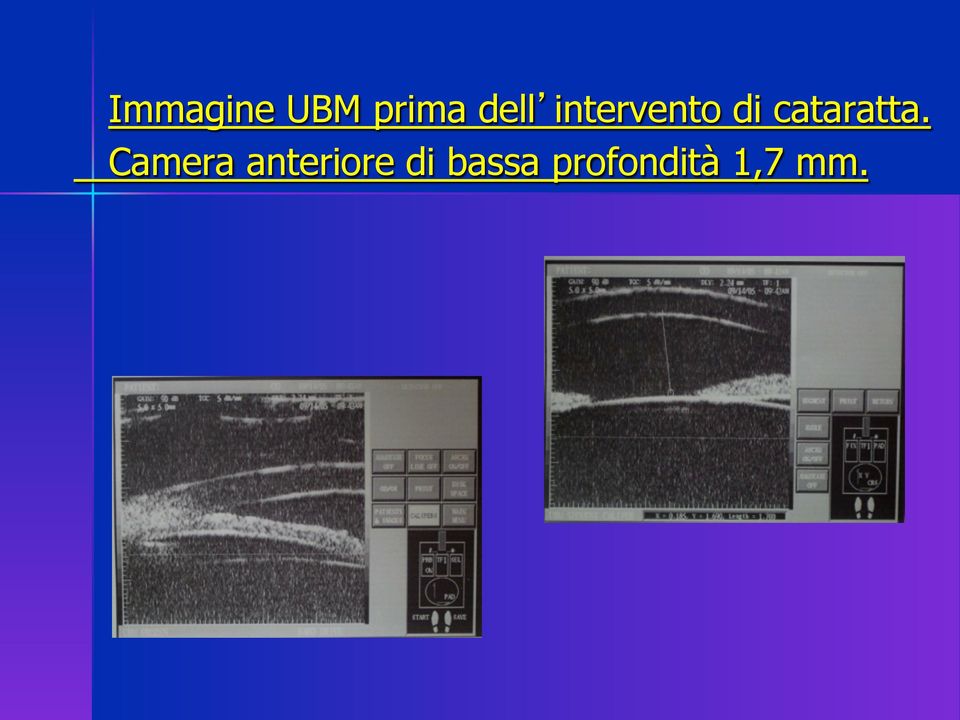 Camera anteriore di