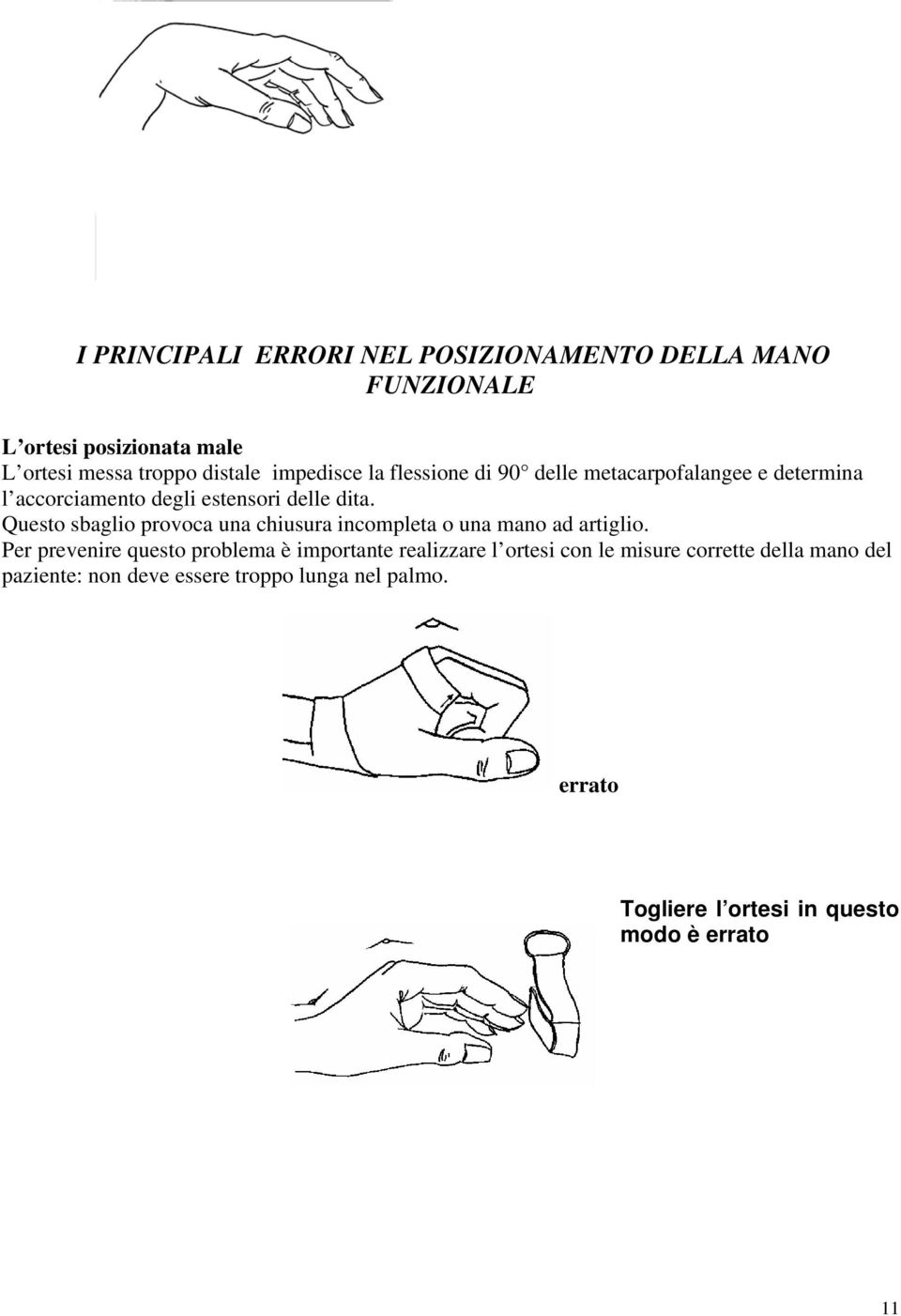 Questo sbaglio provoca una chiusura incompleta o una mano ad artiglio.