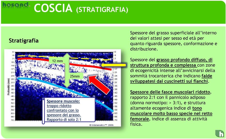 sviluppatesi dai cuscinetti sui fianchi. Spessore muscolo: troppo ridotto confrontato con lo spessore del grasso.