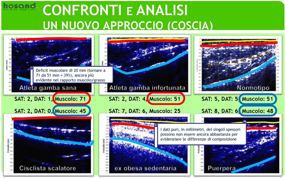 Muscolo: 51 SAT: 2, DAT: 0, Muscolo: 45 SAT: 7, DAT: 6, Muscolo: 25 SAT: 8, DAT: 6, Muscolo: 48 I dati puri, in