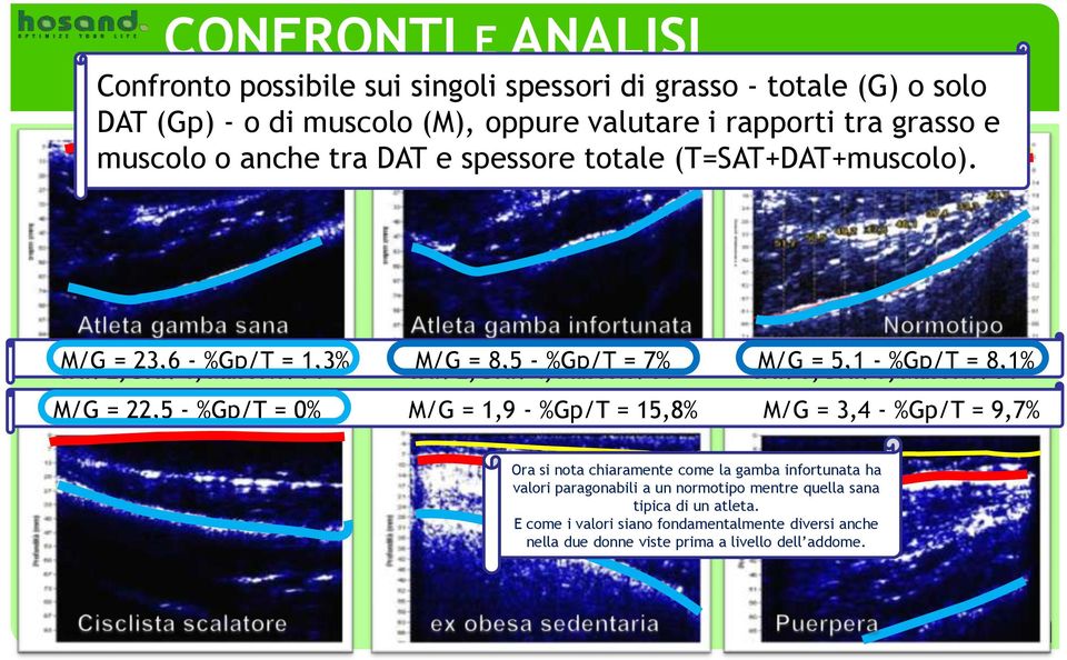 SAT: M/G 2, = DAT: 23,6 1, - %Gp/T Muscolo: = 71 1,3% SAT: M/G 2, = DAT: 8,5-4, %Gp/T Muscolo: = 7% 51 SAT: M/G 5, = DAT: 5,1-5, %Gp/T Muscolo: = 8,1% 51 M/G SAT: 2, = 22,5 DAT: - 0, %Gp/T Muscolo: