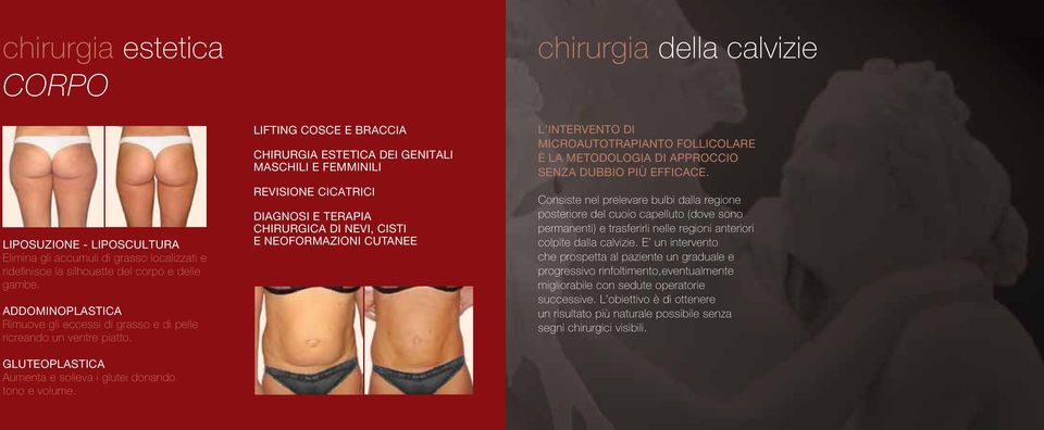 LIFTING COSCE E BRACCIA CHIRURGIA ESTETICA DEI GENITALI MASCHILI E FEMMINILI REVISIONE CICATRICI DIAGNOSI E TERAPIA CHIRURGICA DI NEVI, CISTI E NEOFORMAZIONI CUTANEE chirurgia della calvizie L