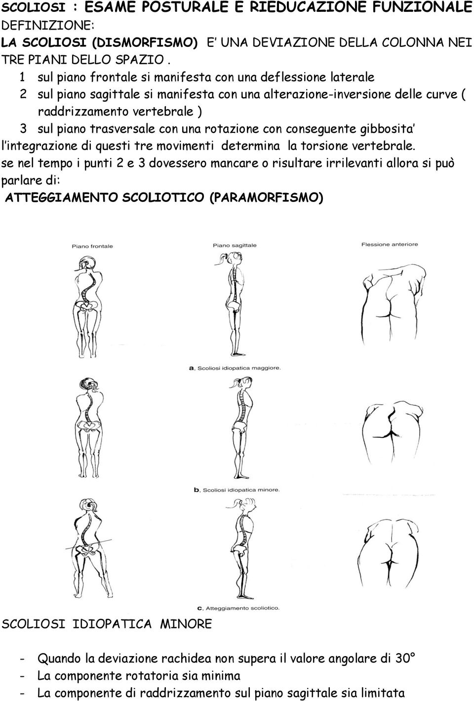 una rotazione con conseguente gibbosita l integrazione di questi tre movimenti determina la torsione vertebrale.