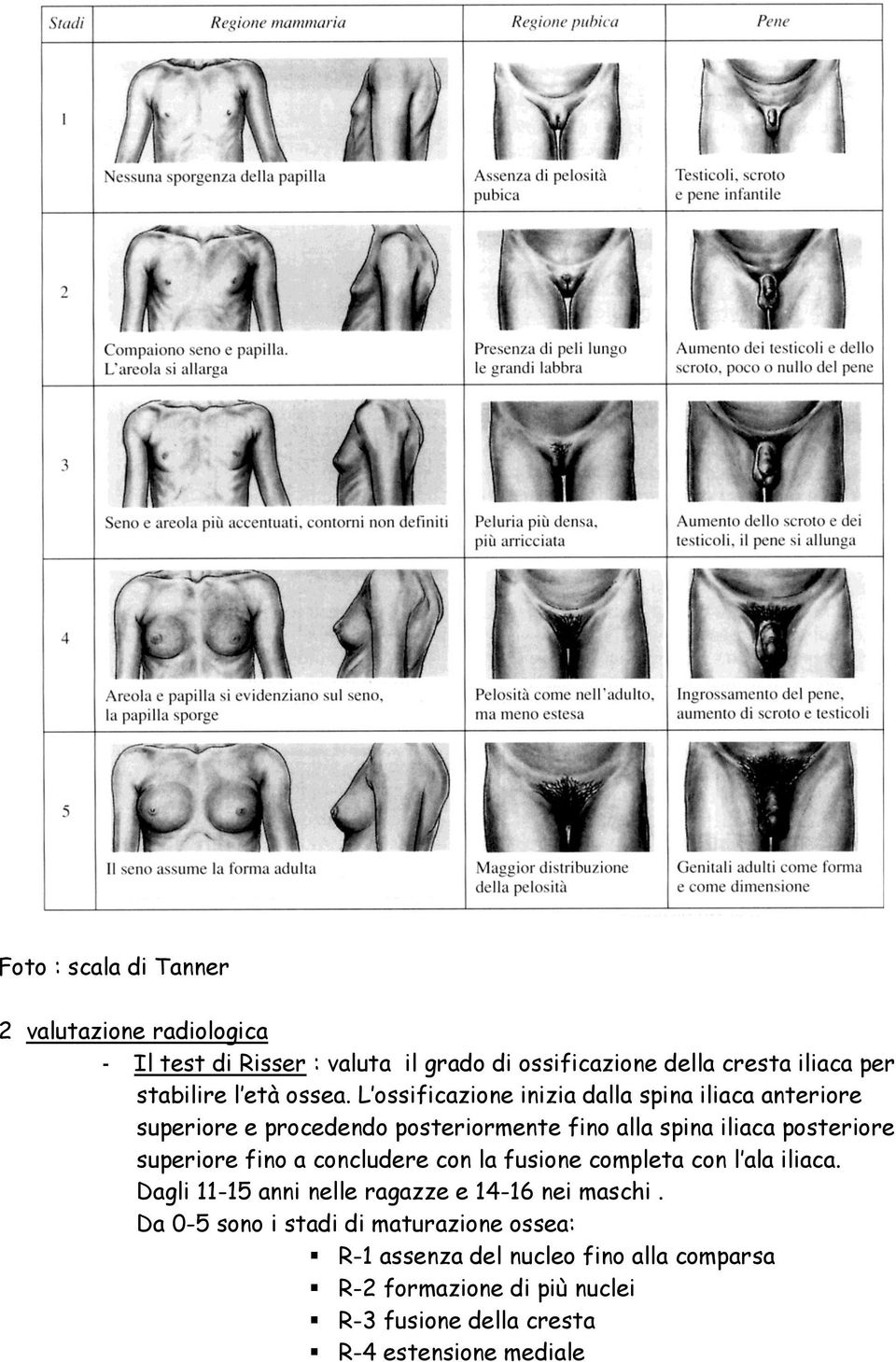 L ossificazione inizia dalla spina iliaca anteriore superiore e procedendo posteriormente fino alla spina iliaca posteriore superiore fino