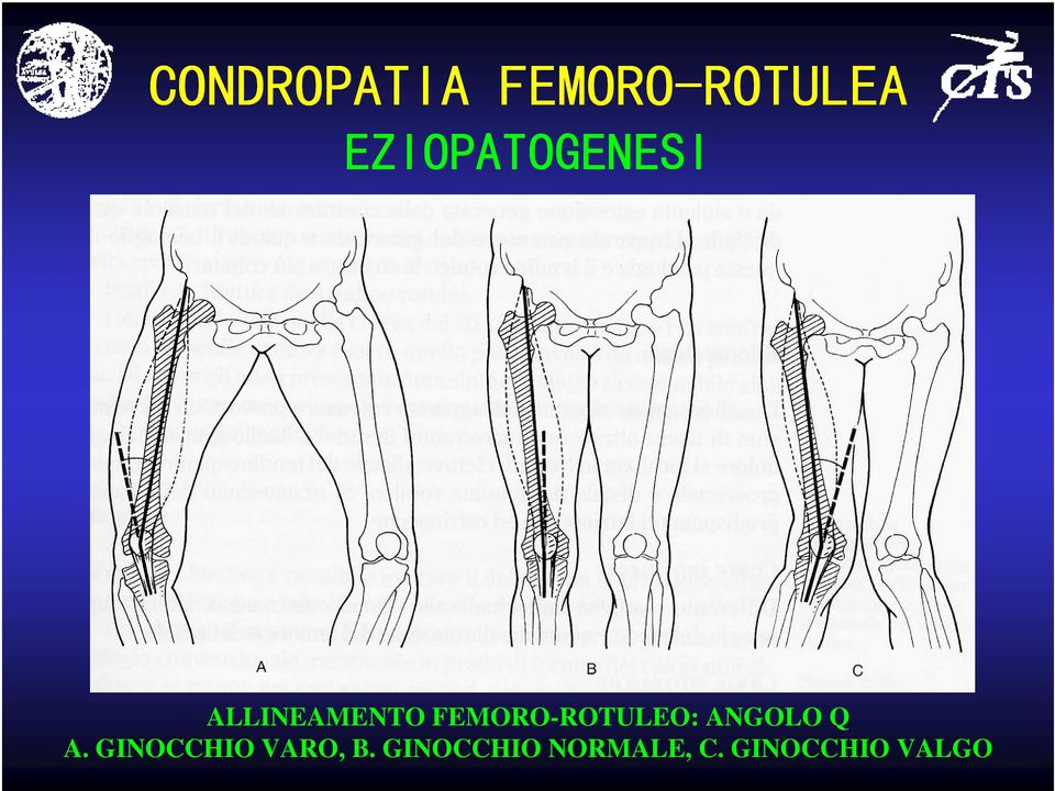 FEMORO-ROTULEO: ANGOLO Q A.