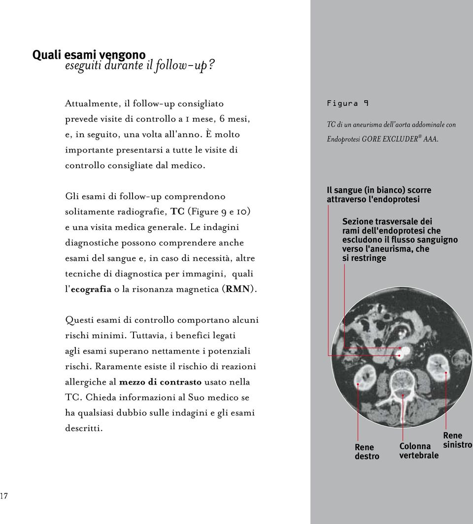 Le indagini diagnostiche possono comprendere anche esami del sangue e, in caso di necessità, altre tecniche di diagnostica per immagini, quali l'ecografia o la risonanza magnetica (RMN).